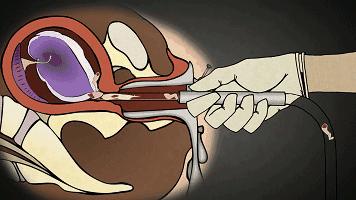 被孩子撞见你会怎么做,做好事被孩子撞见了怎么办