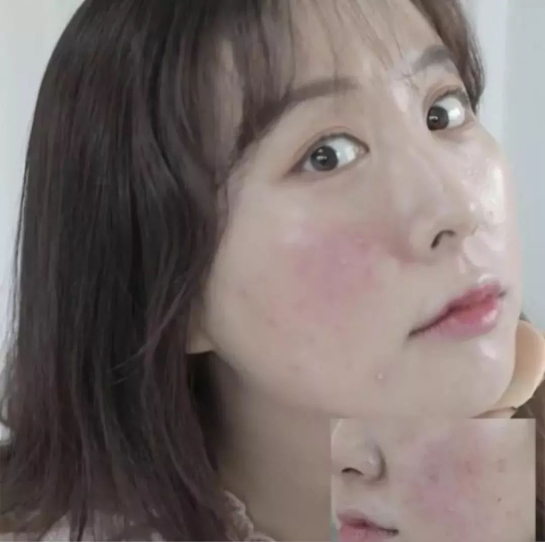 油痘敏感肌气垫推荐,混合皮敏感肌气垫推荐