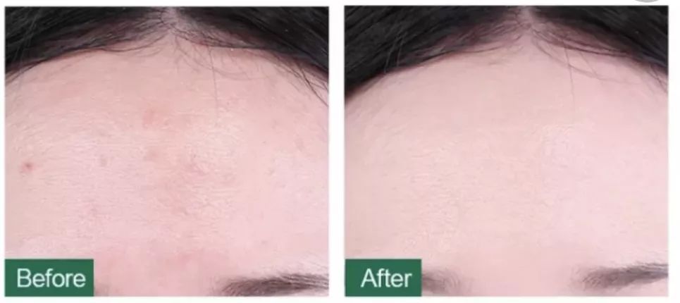 油痘敏感肌气垫推荐,混合皮敏感肌气垫推荐