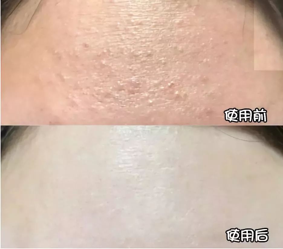 还在用洗面奶洗脸卸妆就out了！用它轻轻一刷，几秒就能深层清洁每个毛孔，感觉黑头都蹦出来了！