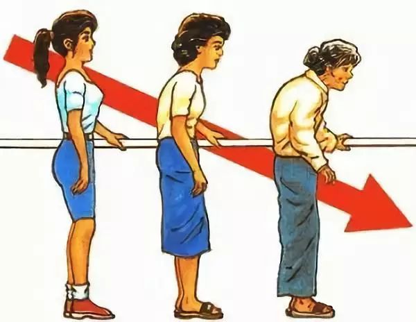 世界骨质疏松日,70岁老人骨质疏松严重症状及治疗