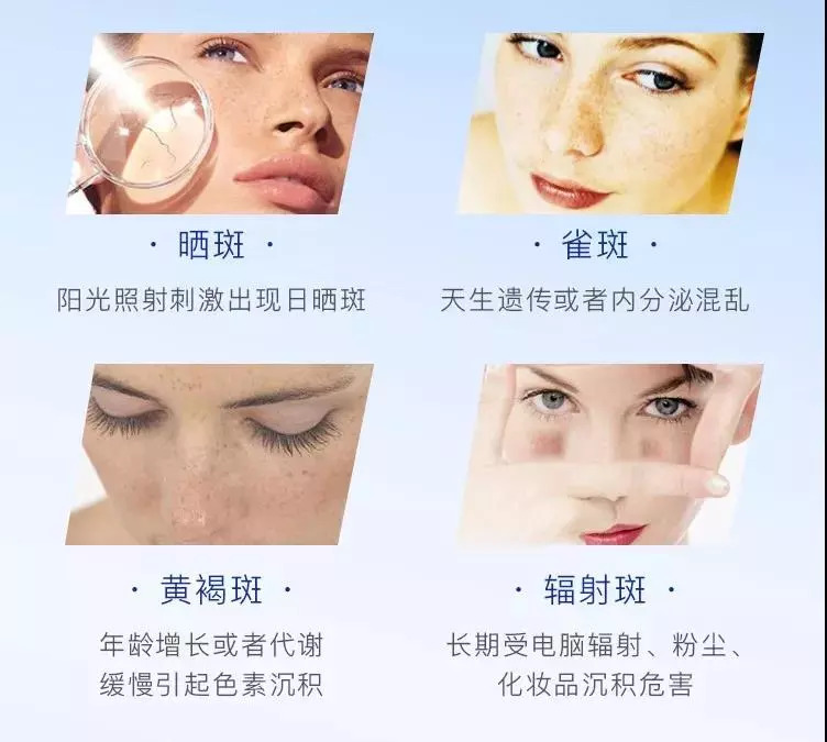 来自日本的HQ祛斑霜,一月一支,淡斑抗皱,让肤色重回净白透亮