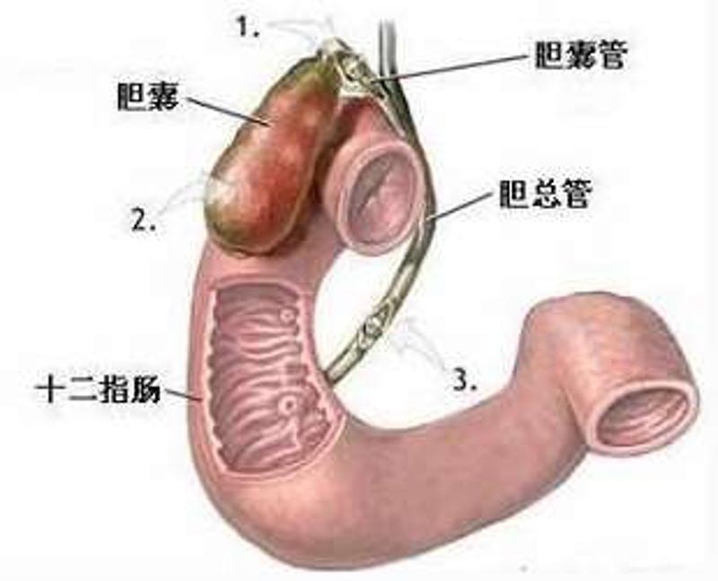 孕妇得了胆囊炎忌口食物有哪些,胆囊炎要忌口哪些食物