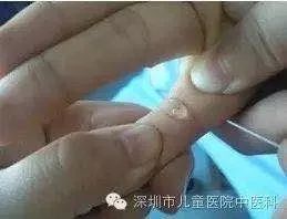 孩子不爱吃饭？知道真相的我眼泪掉下来……