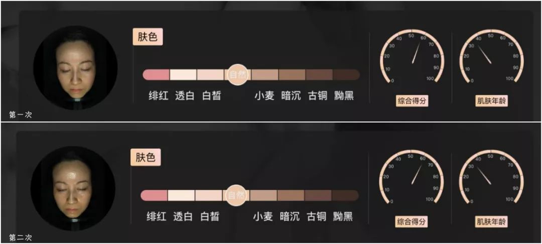 灏忚寕鑲岃瘖瀹ゅ埌搴曟湁澶氬己,灏忚寕鑲岃瘖瀹よˉ姘村悧