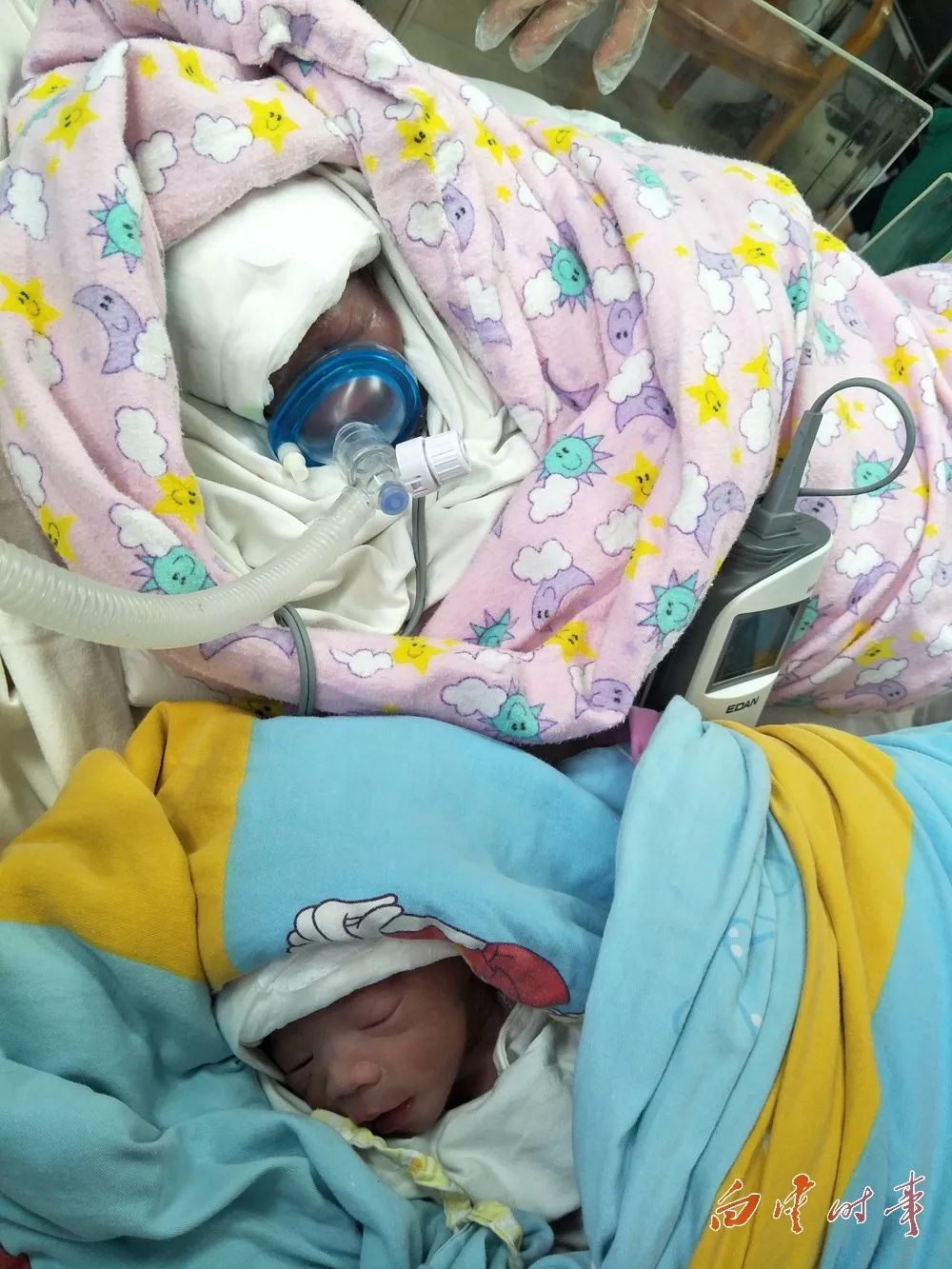 白云区二医院一孕妇平安顺产一对龙凤胎