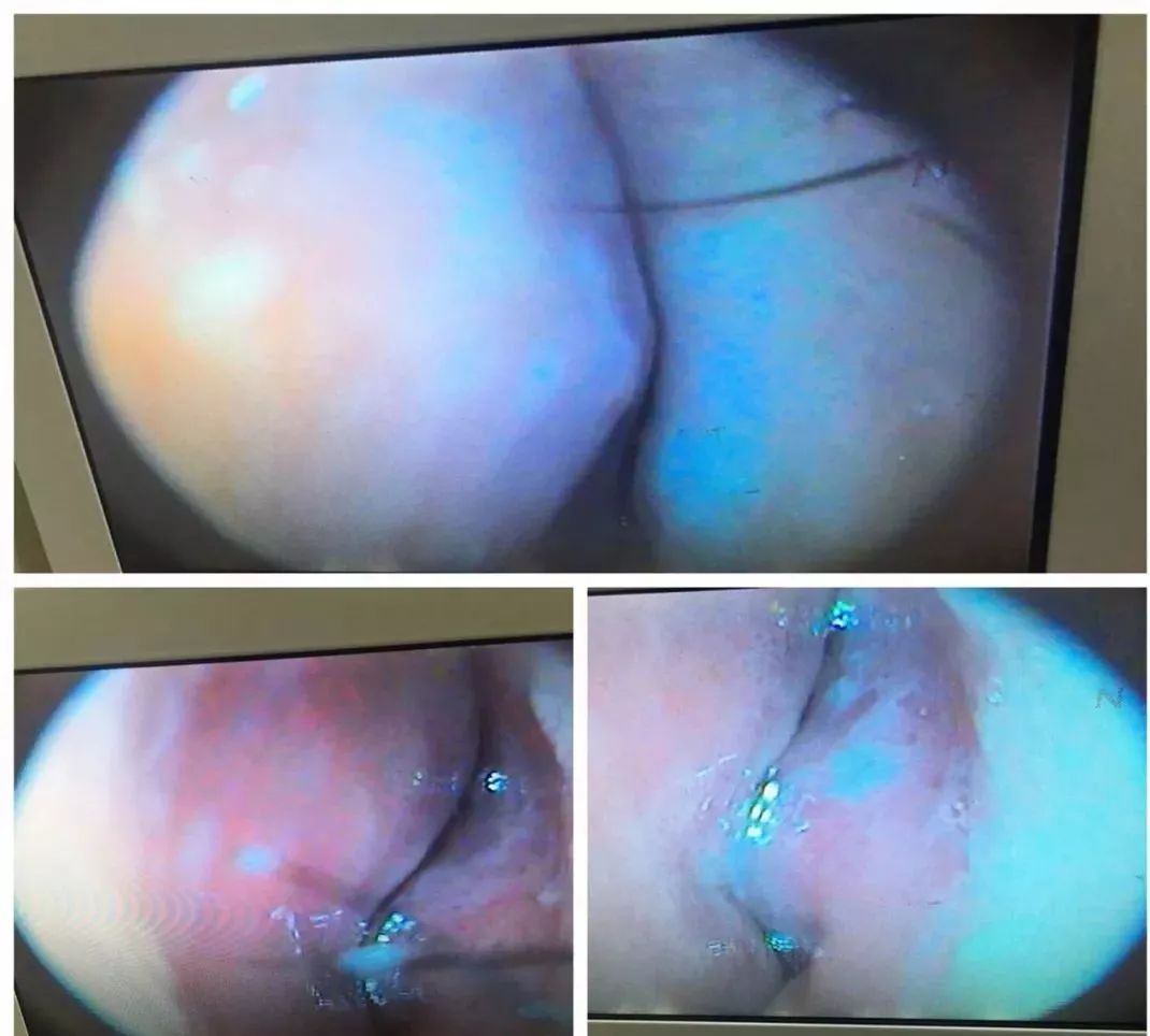 四退原则出炉：“无论什么原因，鼻炎治不好就退款！”常州这家诊所打了谁的脸？