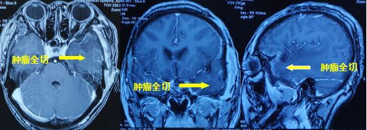 因祸得福第二集,因祸得福上下集免费