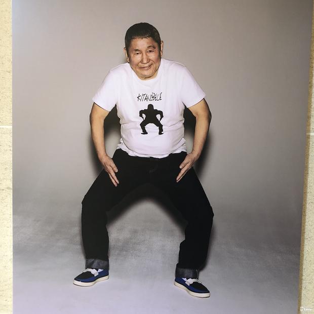 北野武疑似脑梗塞先兆，健康状况堪忧？