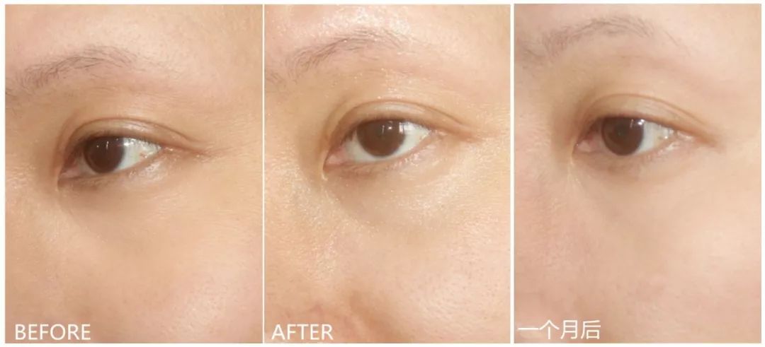 兰蔻明星大红瓶,兰蔻彩妆明星同款产品有哪些