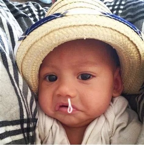 骑车后鼻子流鼻涕,冬天骑车吹风老是流鼻涕