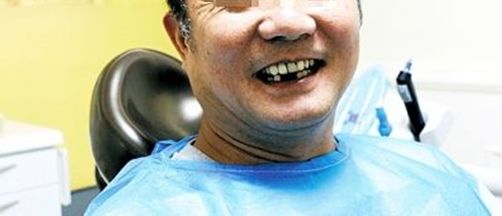 哪十家医院种植牙享受补贴,缺牙市民可申请免费种牙