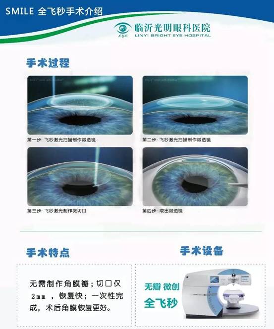 临沂飞秒哪个医院最好,临沂可以做全飞秒手术吗