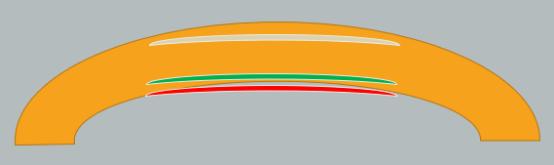 孙旭光眼科医生,孙旭光大夫角膜塑形镜危害