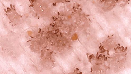 肉眼可见的除螨效果，日本爆款除螨贴，24小时不间断，除螨率高达97%