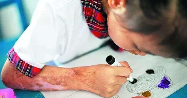 奶奶转个身，女孩烫掉一层皮严重休克...咋回事？每个家长都该看看