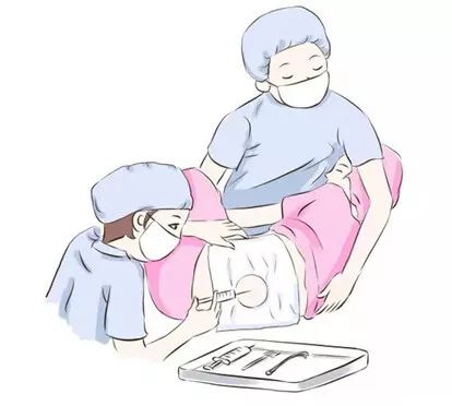 无痛分娩是真的不疼吗,无痛分娩生的时候真的无痛吗