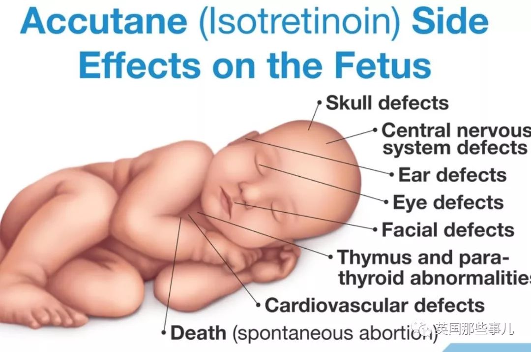本来只想吃药治个痘，却让自己长期不举？这群英国男人无比忧桑……
