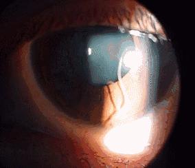 猫狗弓形虫是怎么传染给人的,弓形虫会通过猫传染给狗吗