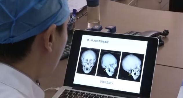 小孩子8岁了嘴巴合不拢,5岁小孩经常心疼怎么回事