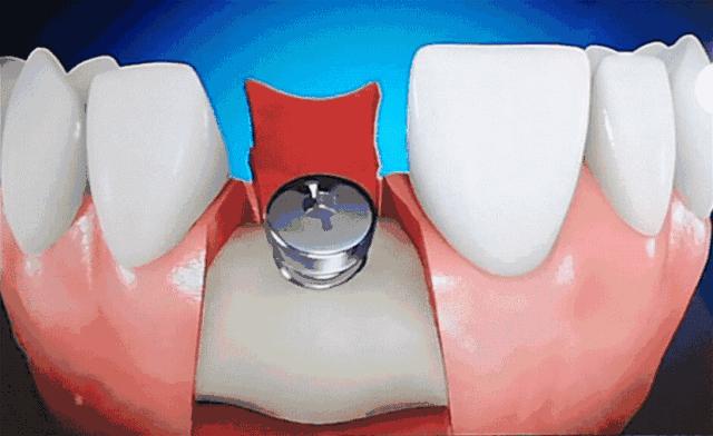 疫情大动作,武汉大动作