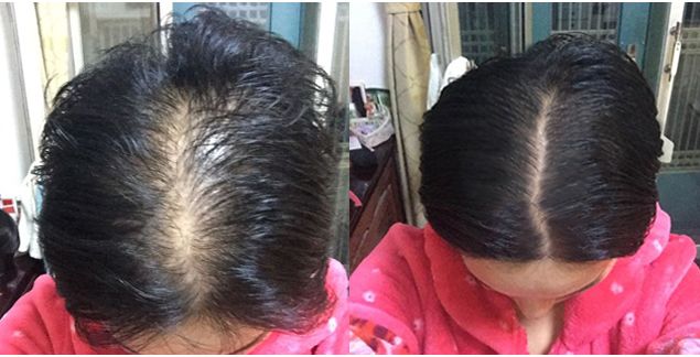 额前长小碎发,额前小碎发往后长