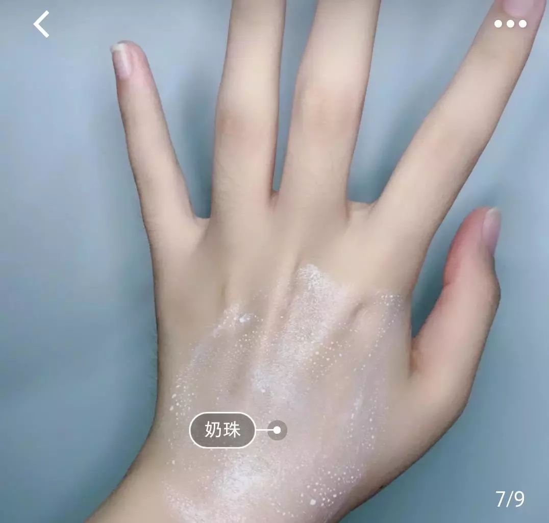 脱发算啥!90后已经开始长“老年斑”了,有人还为此花了10多万!