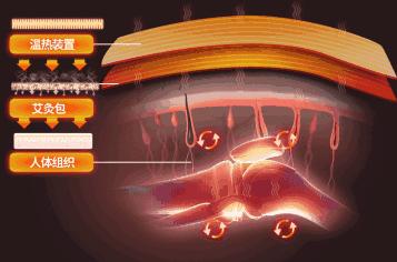 富贵包导致脖子筋痛用什么治疗,富贵包消除的最佳神器