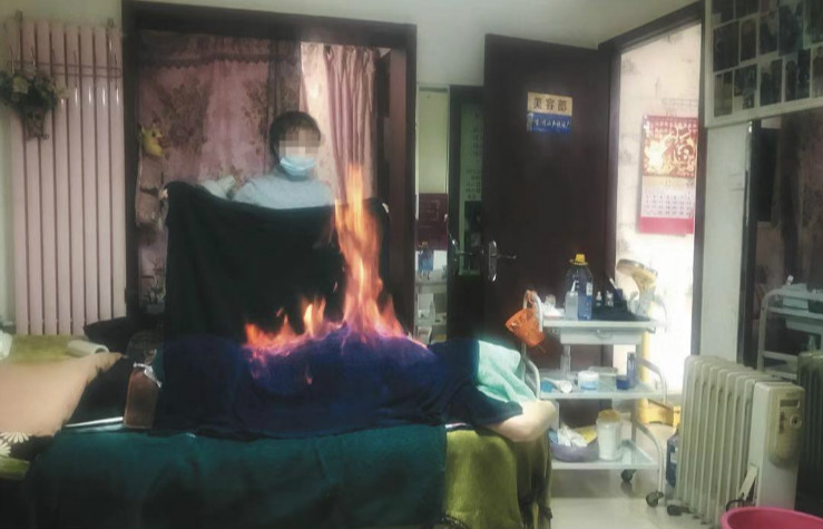 权健火疗：“金牌技师”自称观火断病