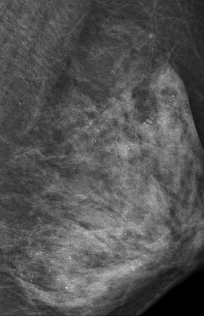 女子这个部位满是“沙子”,不得不全部切除!只因这项坑惨无数人的操作