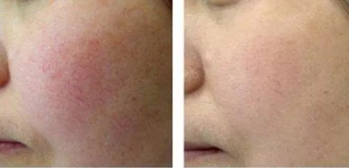 新年新气象从焕新开始,新年新气象开工好彩头