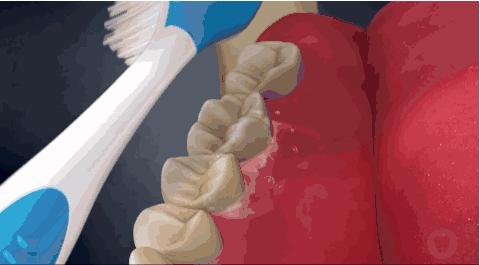 不到1折疯抢！全家口腔健康有保证~29.9元抢购原价895元劲松牙科家庭口腔护理套餐！超声波洁牙+中老年口腔护理+儿童口腔护理…