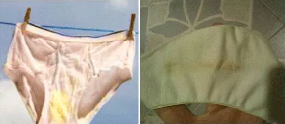 内裤变脏黄黑是什么病,裤子上有黄黄的东西是怎么回事