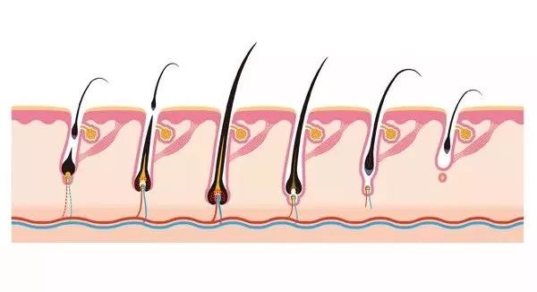 头发狂脱？不哭，看完这篇还有救！