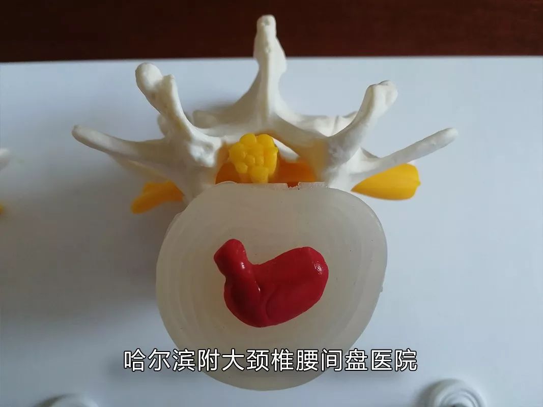 有没有感觉到腰酸腿疼特别棒,你是否觉得腰酸背痛容易累