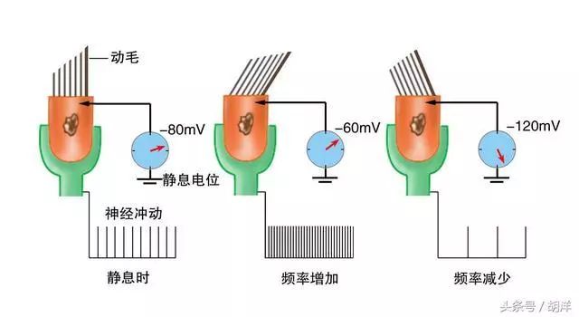 导致支气管扩张症最常见的病因,支气管扩张自幼发病