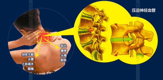 脖子酸痛怎么缓解仪器,脖子肩膀酸疼怎么缓解