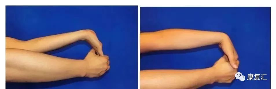 手指麻木刺痛,手指手术后麻木康复训练法