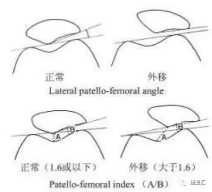 膝关节不同部位疼痛的病因分析,膝关节疼痛的十大原因及治疗