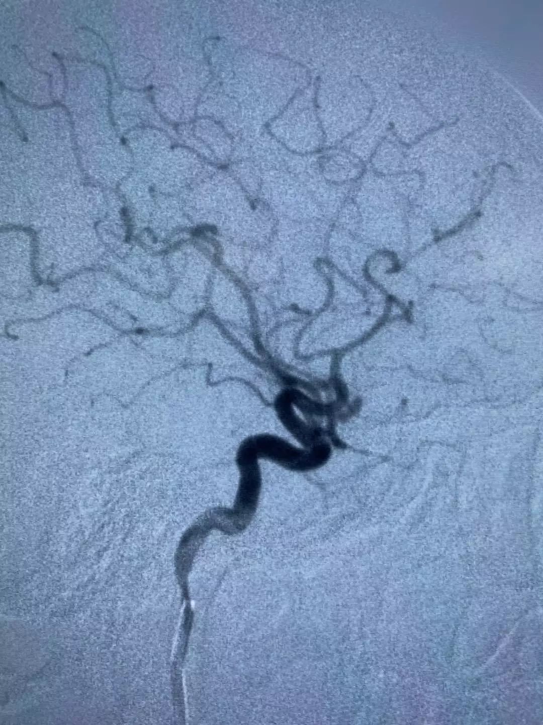 「新世相」因过年太累，男子被送医抢救……这几个保命技巧一定要知道