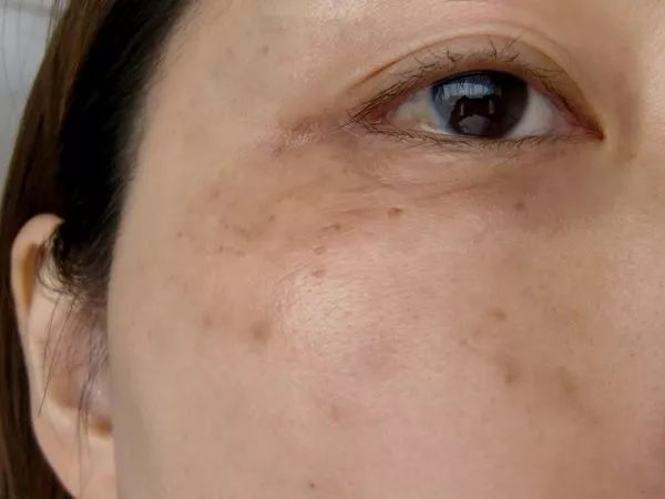 日本流行的美容方式是什么,日本推荐28天美容换脸法