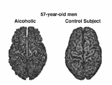 睡前喝酒怎么戒掉,爱喝酒怎么戒掉