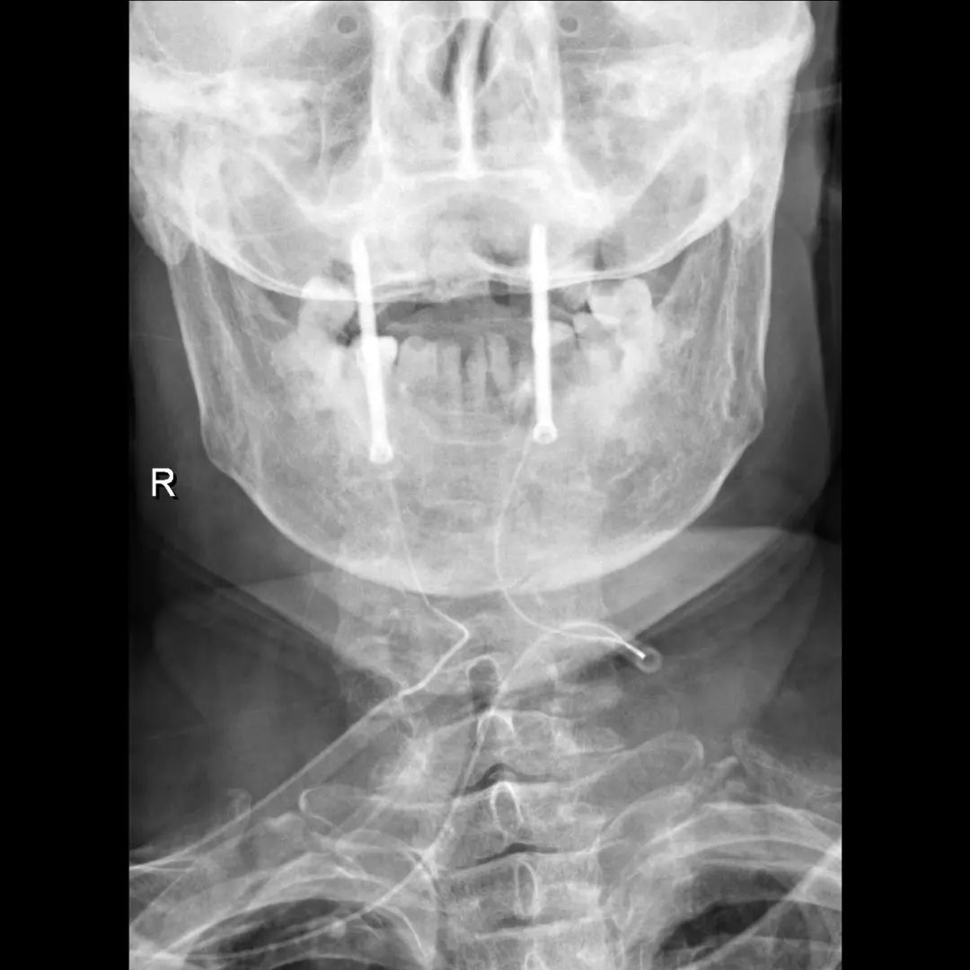鍕囬棷鐢熷懡绂佸尯鍖婚櫌,鍕囬棷鐢熷懡绂佸尯浜旀鍙仠鎵嬫湳