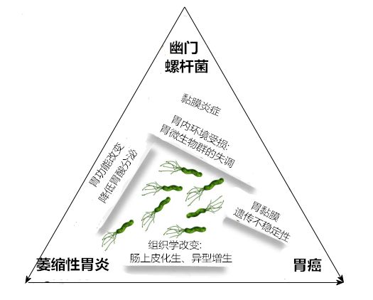 幽门螺杆菌导致萎缩性胃炎能治吗,萎缩性慢性胃炎幽门螺杆菌怎么治