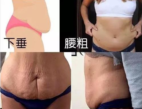 胖姑娘逆袭成模特身材？日本收腹裤，1秒隐藏大肚腩，显瘦20斤