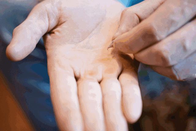 美白针可以10天打一次吗,可以美白的针