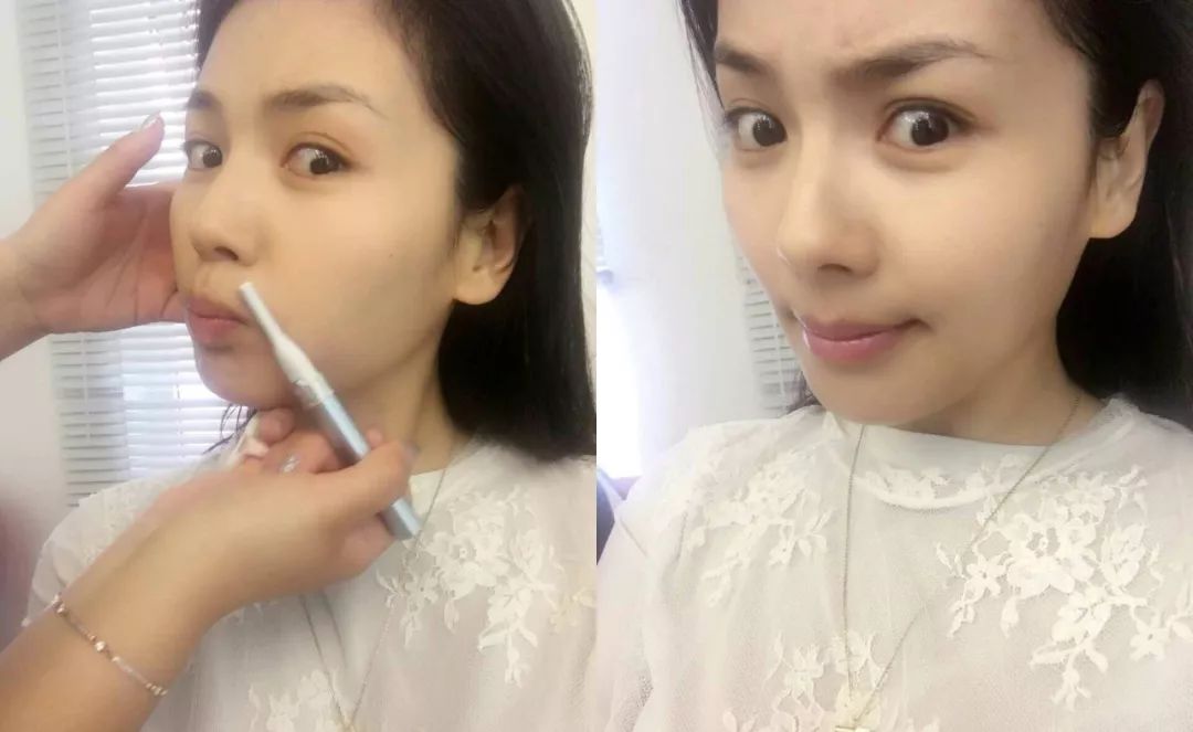 猕猴桃女孩一定要脱毛吗,夏天的猕猴桃