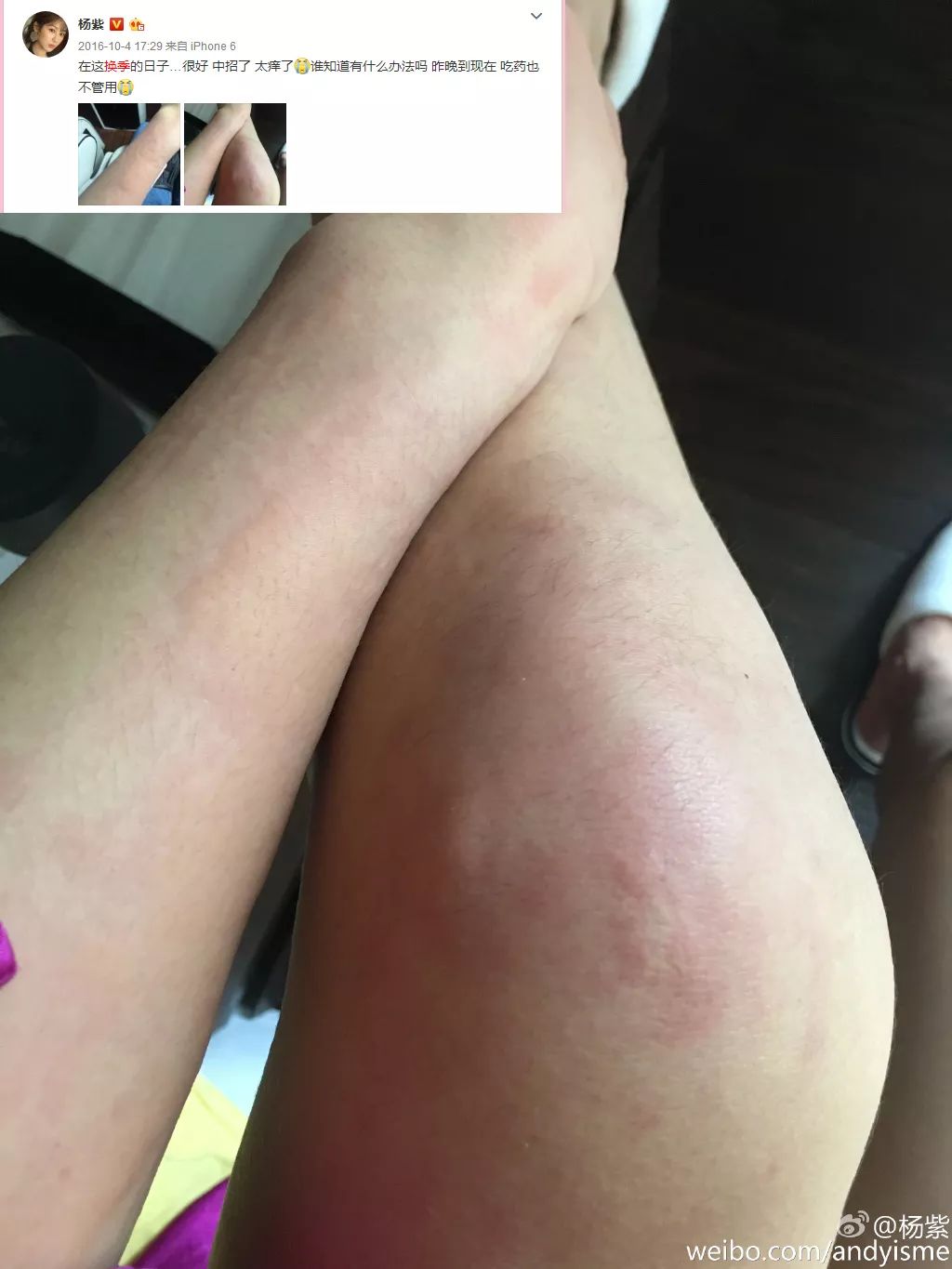 猕猴桃女孩一定要脱毛吗,夏天的猕猴桃