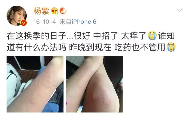 欧阳娜娜水光肌面膜,欧阳娜娜面膜水光肌