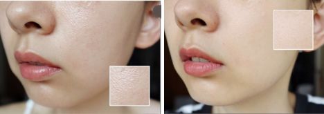 祛斑美白补水祛皱祛痘,祛斑祛痘美白改善暗沉